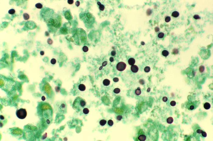 Histology of Cryptococcus- "Narrow Based Buds" 