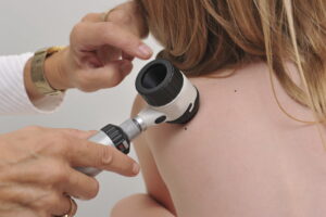 Models applying medical tool to shoulder | perri dermatology