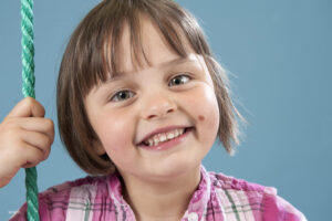 Little girl with mole on face