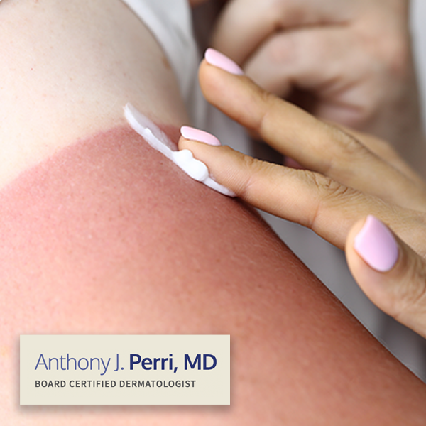 Model demonstrates rubbing lotion over a sunburned arm