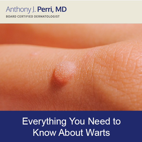 Wart on Finger Example