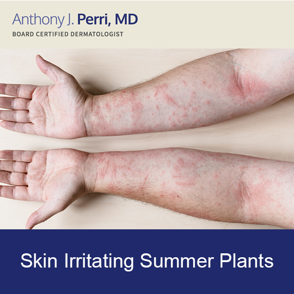Model example of skin irritation after contact with plants that grow wild in summer