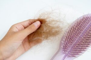 Large clump of hair being pulled out of a hairbrush | perri dermatology