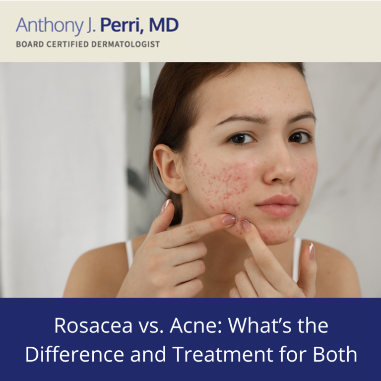 Rosacea Etiology Perri Dermatology