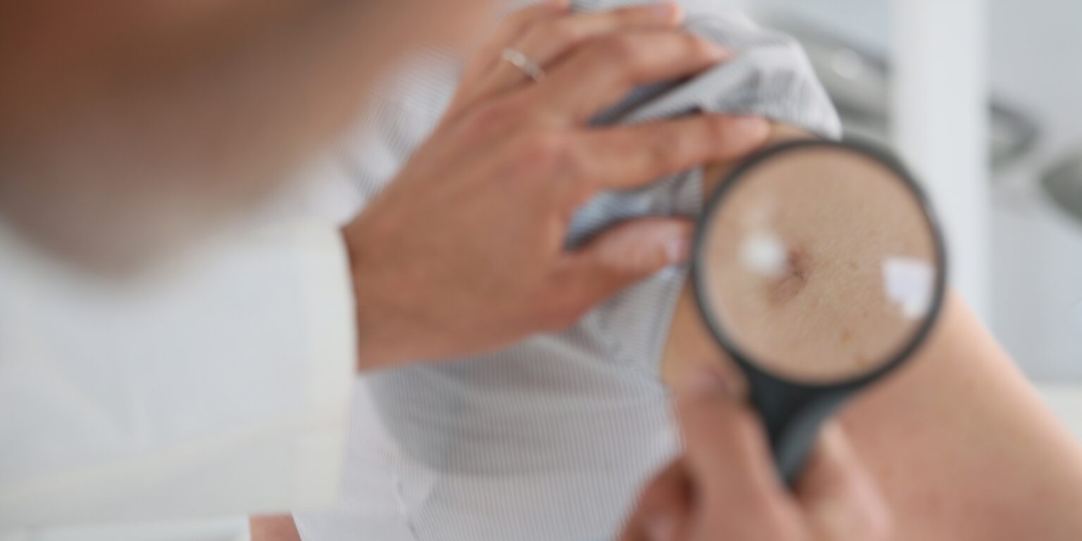 Annual Skin Exams Perri Dermatology Texas Dermatologist