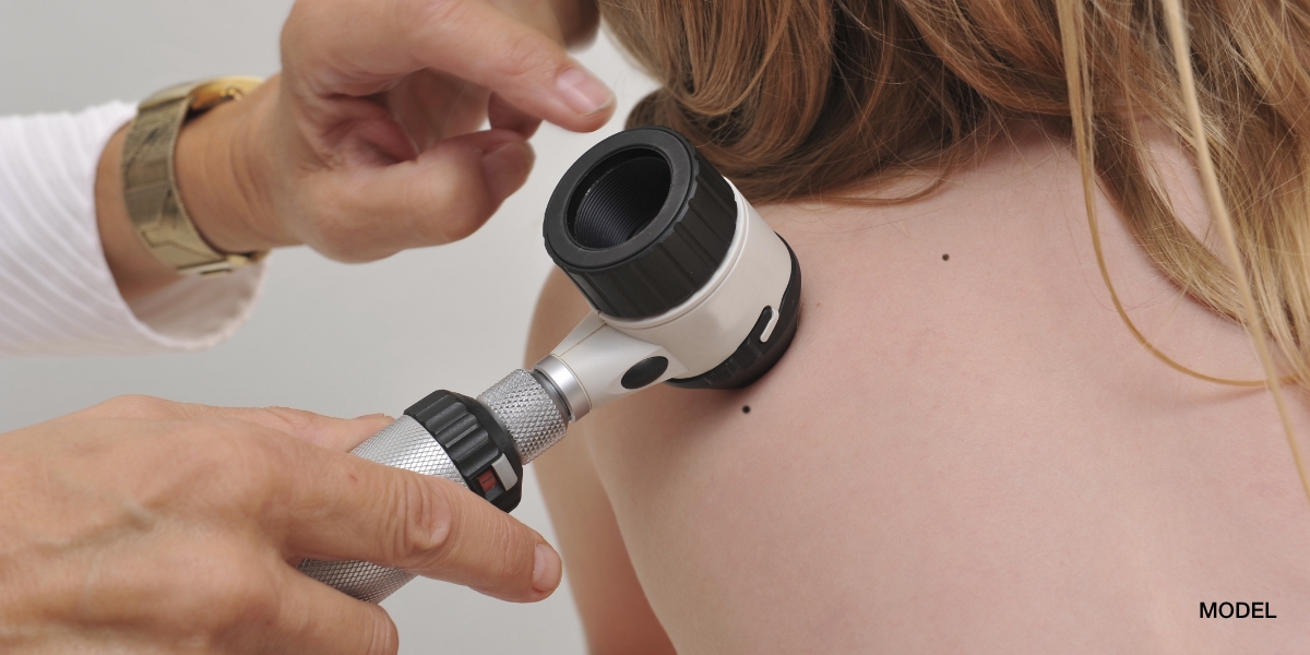 Doctors hands examining skin closely | perri dermatology